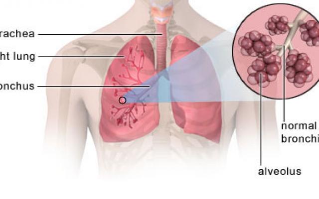 Persona sin bronconeumonía. Bronquiolos y alveolos sanos